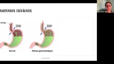 El Atrio y El Cuerpo Humano 7