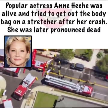 DON'T FORGET: Anne Heche Was ALIVE in a Body Bag