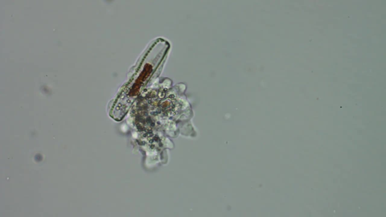 Polychaos-Fasciculatum Amoeba