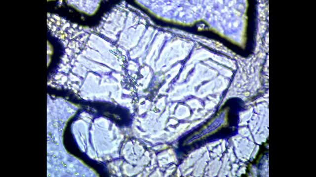 La Quinta Columna con más evidencias de Grafeno, Microtecnología y Morguellons en la vacuna Pfizer