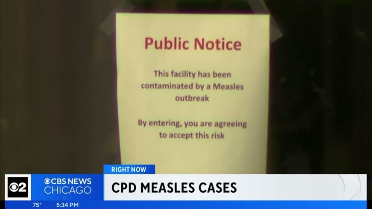 Chicago Police Department suffers an Measles Outbreak - Thank You Open Borders