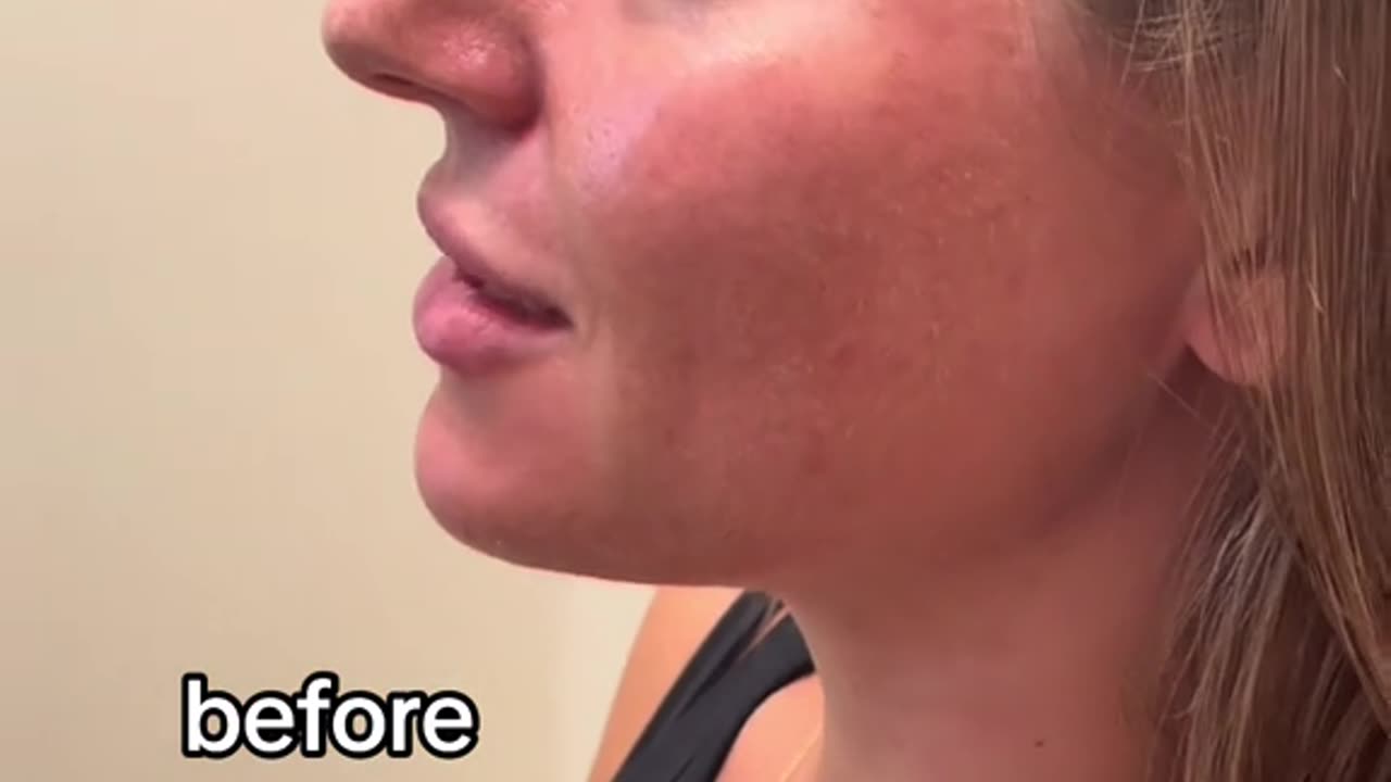 To achieve your ideal skin