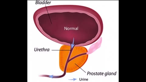 Exploring the Benefits of Prostadine: A Comprehensive Guide