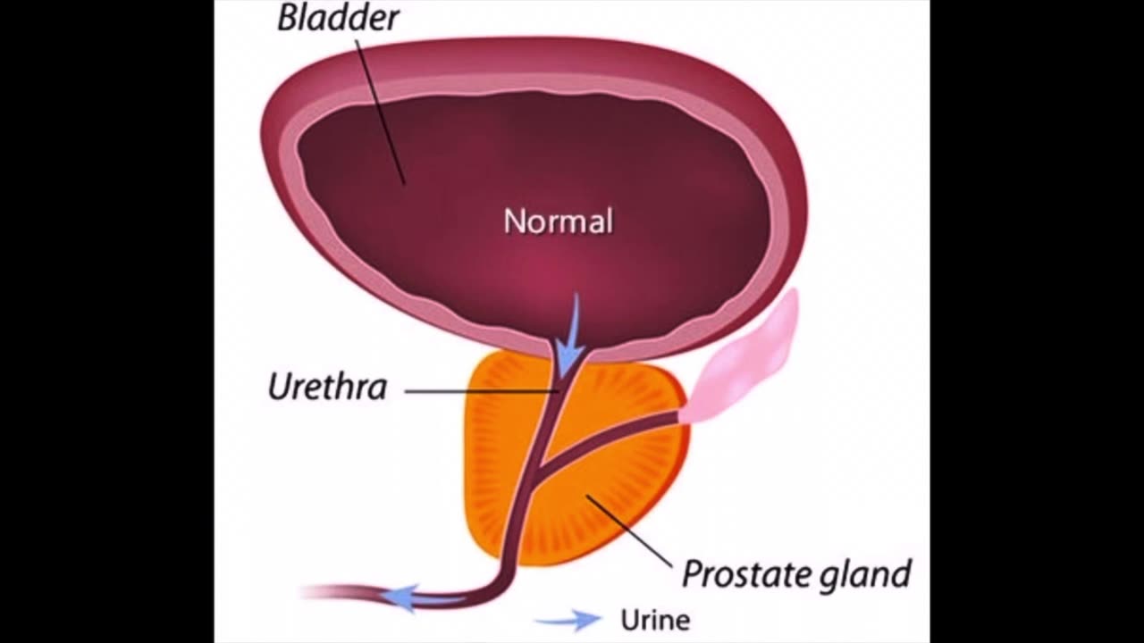 Exploring the Benefits of Prostadine: A Comprehensive Guide