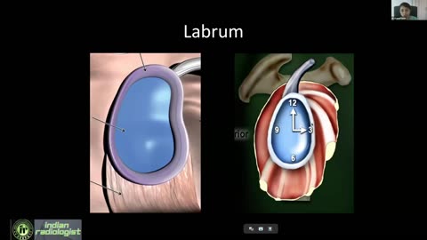 MRI Shoulder How to Do