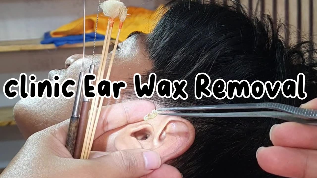 Ear-Cleaning removal ASMR wax