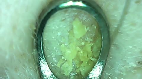 Satisfying whiteheads