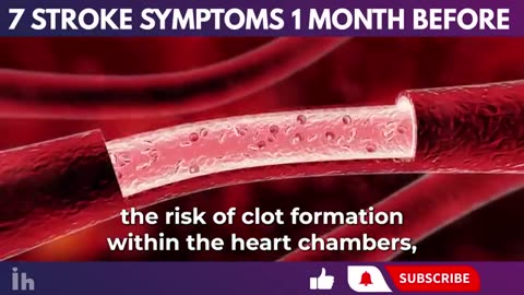 7 stroke symptoms 1 month before it happens(detect it quickly )