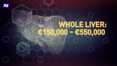 The Price of Ukrainian Organs