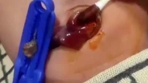 how to clean umbilical cord of new born baby