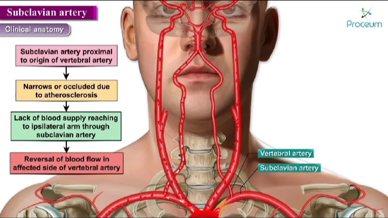 Subclavian Artery clinical anatomy