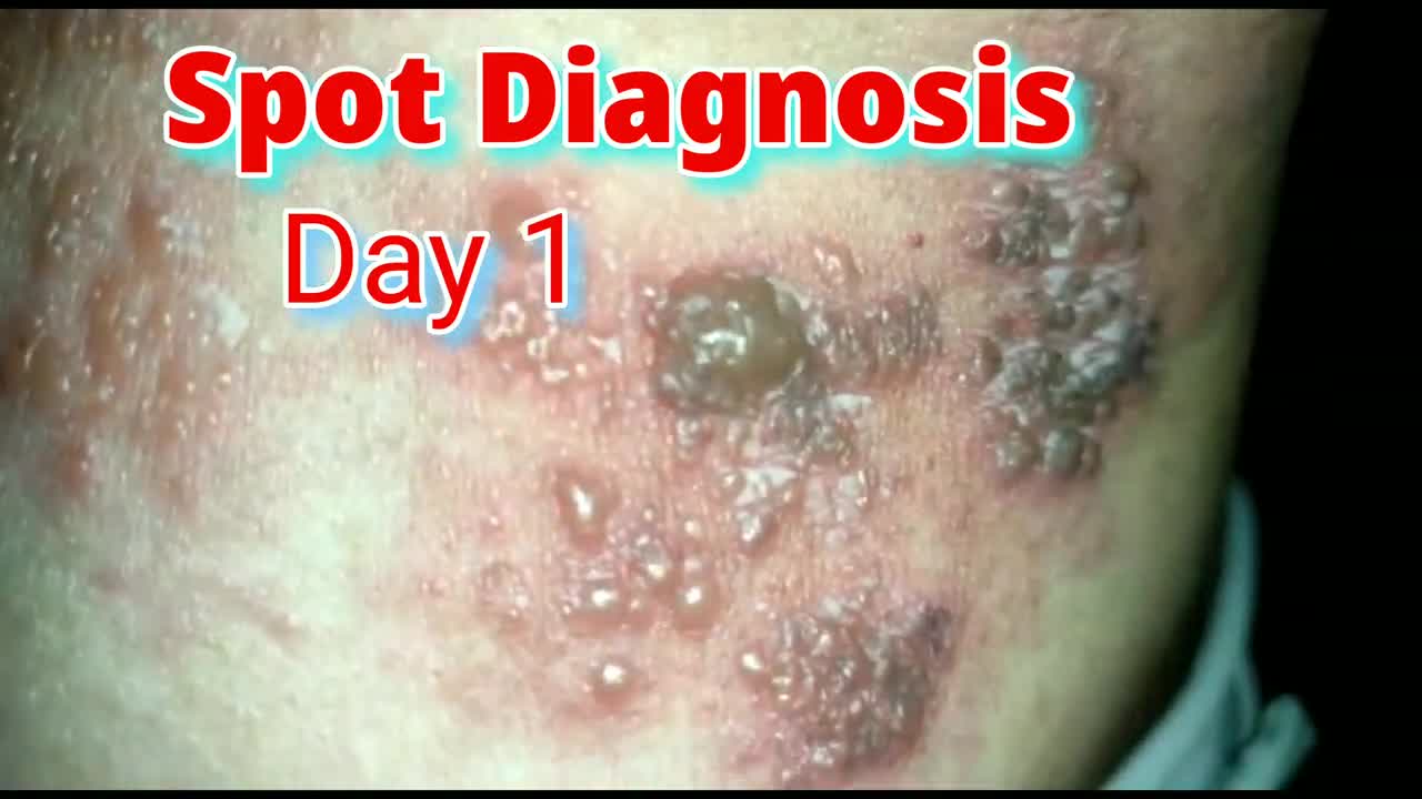 Spot Diagnosis Skin Lesions