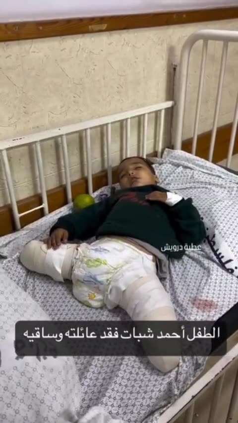 Ahmad Shabat Lost His Whole Family And Both His Legs In An Israeli Airstrike.