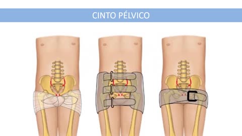 Via Verde Trauma - Aula 7 - Cinta Pélvica