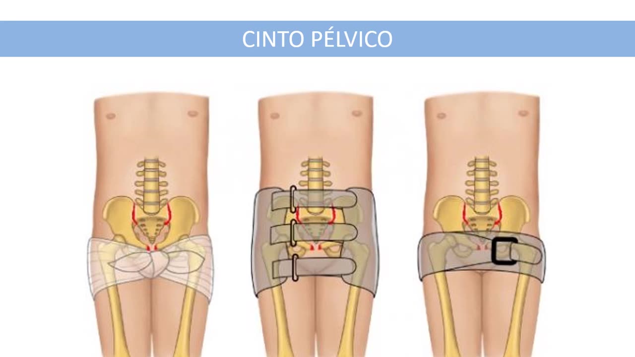 Via Verde Trauma - Aula 7 - Cinta Pélvica