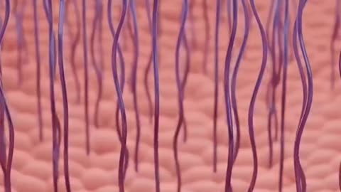 Laser Resurfacing