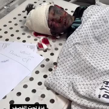 Civilians injured during Israeli bombing in Gaza