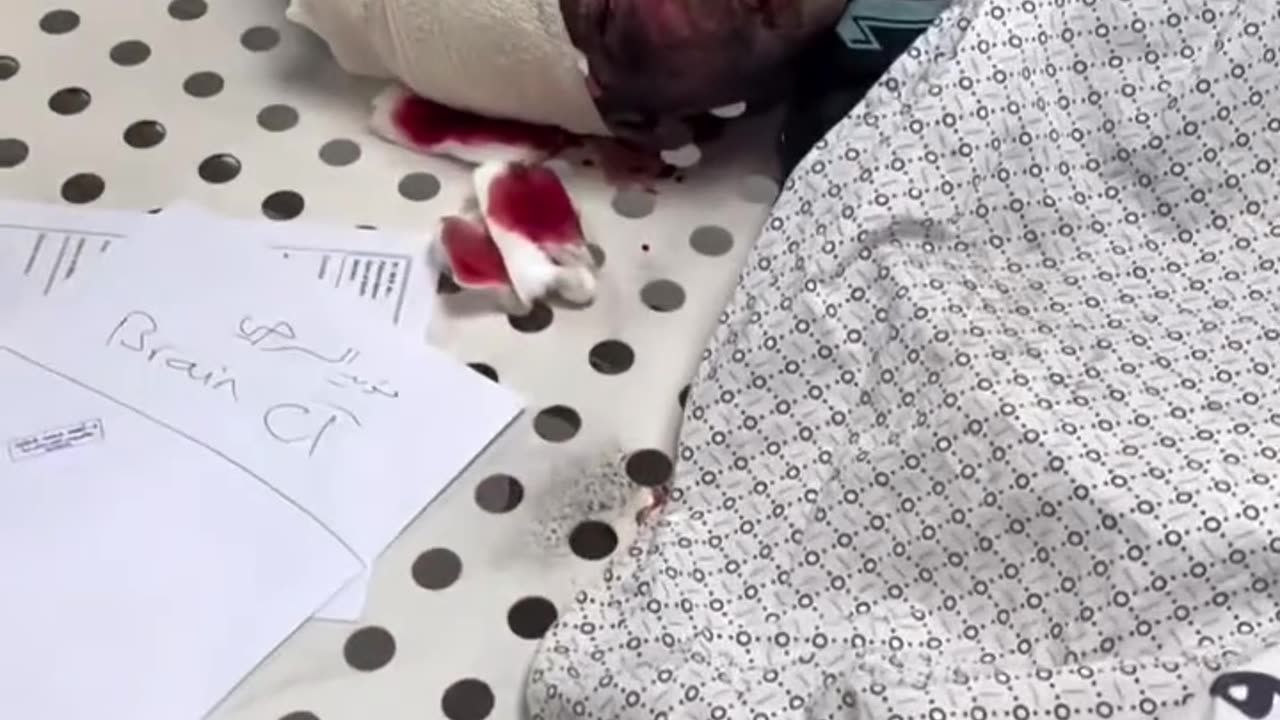 Civilians injured during Israeli bombing in Gaza
