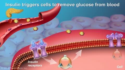 Understanding Type 2 Diabetes In The Simplest Way-Part 1