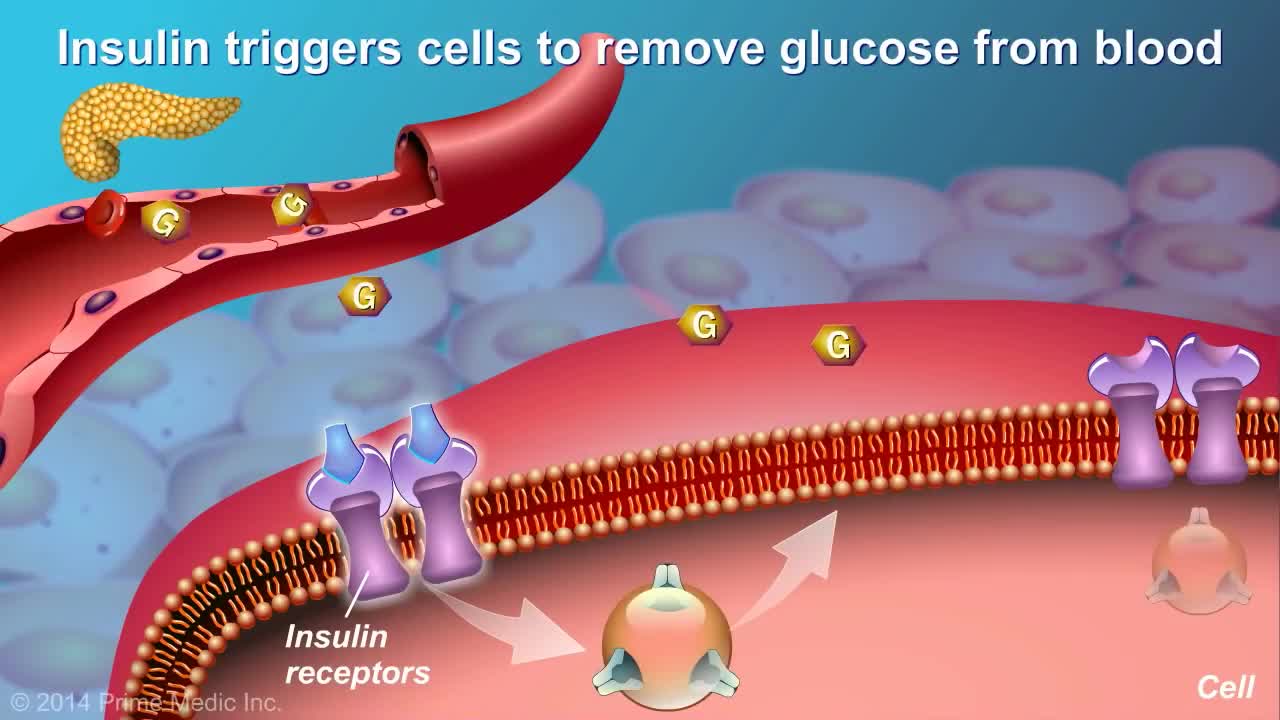 Understanding Type 2 Diabetes In The Simplest Way-Part 1