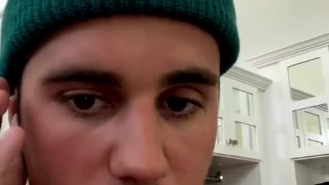 Justin Bieber has half his face paralyzed