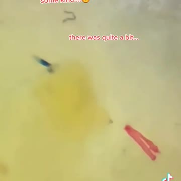 McDonalds- plastic fibers- morgellons fibers-graphene oxide