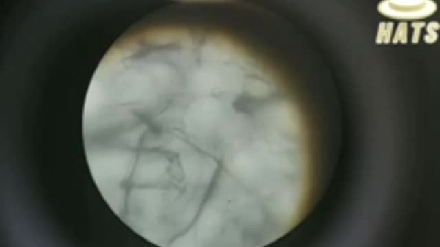 WOW Graphene Oxide found in masks!!!