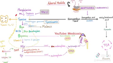 Pheochromocytoma (Adrenal Tumor)