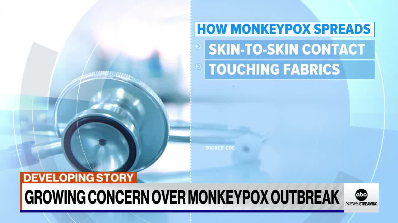 State of Emergency declared in US amid Monkeypox outbreak.