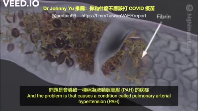 mRNA疫苗刺突蛋白造成血栓