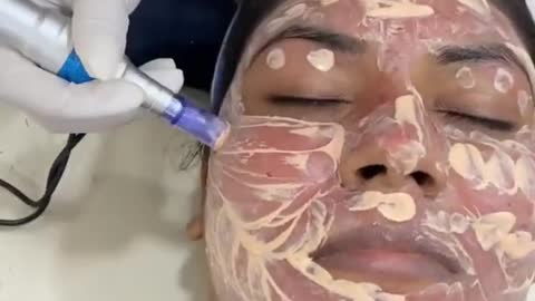 Face treatment