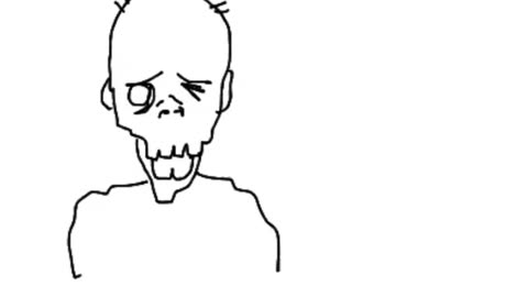 VXD