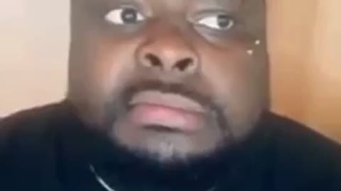 This guy also gets Bell Palsy from covid jab