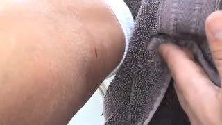 Cactus Thorn Removal