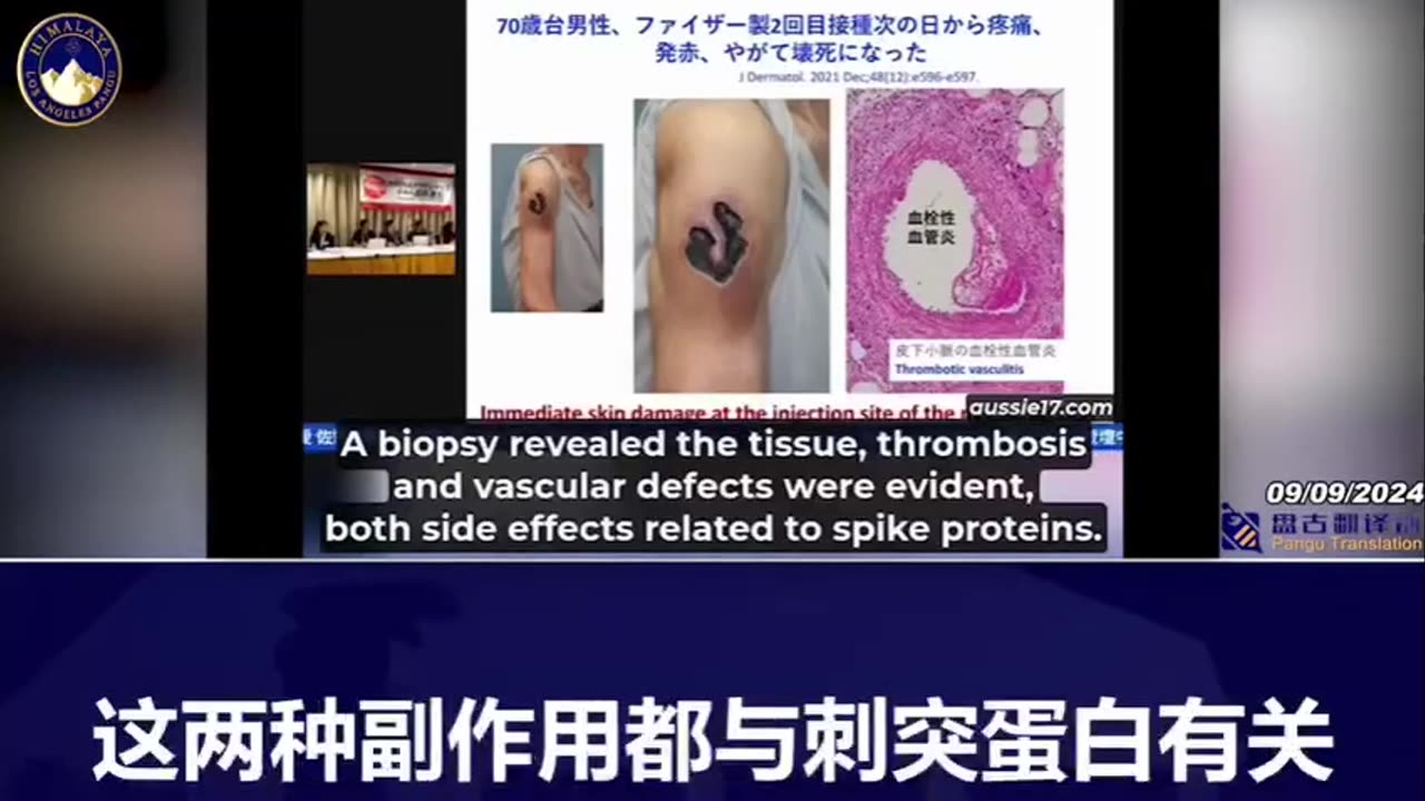 ҉D҉r҉.҉ ҉S҉h҉i҉g҉e҉t҉o҉s҉h҉i҉ ҉S҉a҉n҉o҉，現任日本🇯🇵高知大學的醫學院皮膚科教授兼主任，在上個月的新聞發佈會