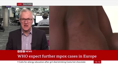 More mpox expected in Europe over the coming weeks, World Health Organization warns |