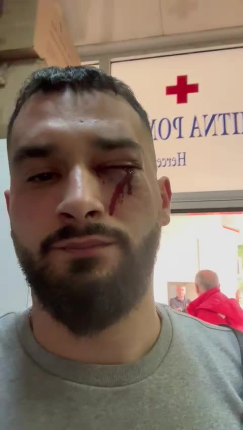 Dhunimi barbar i tre të rinjve në Mal të Zi,