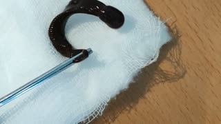 Parasite Pulled from Man's Nose