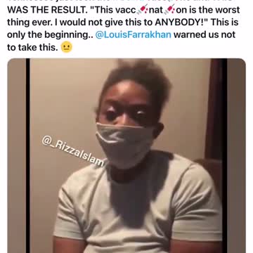 Nurse gets Bells Palsy from CoVid19 Vaccine