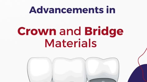 crowns and Bridge | Dr. Rashmi Shree | Dentist in Bannerghatta Road | Bangalore