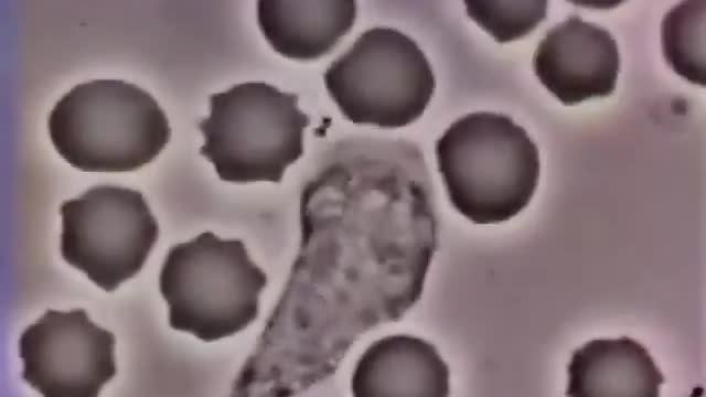 CREACION DE DIOS: SISTEMA INMUNOLÓGICO NATURAL, GLOBULO BLANCO PERSIGUIENDO UNA BACTERIA