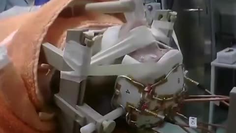 Esperimento del chip cerebrale Neuralink. Elon Musk ti sarà fatto lo stesso.