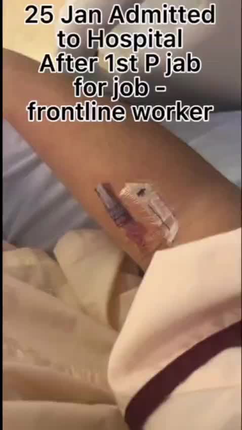 Frontline worker lost both legs after vax