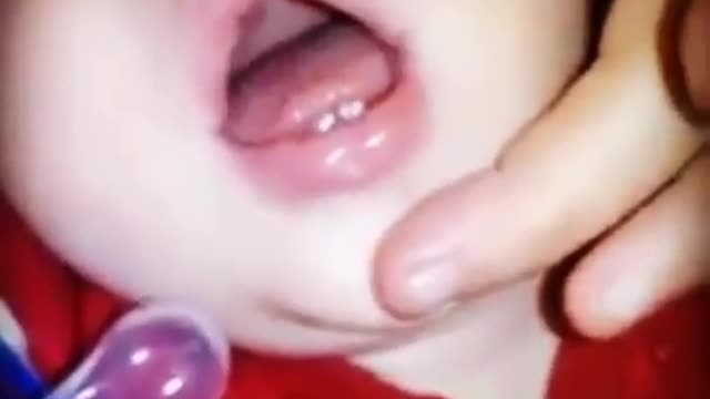 What's wrong with this mouth