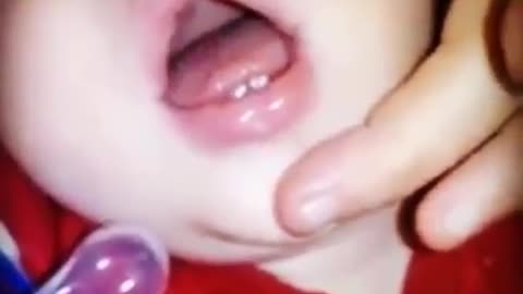 What's wrong with this mouth