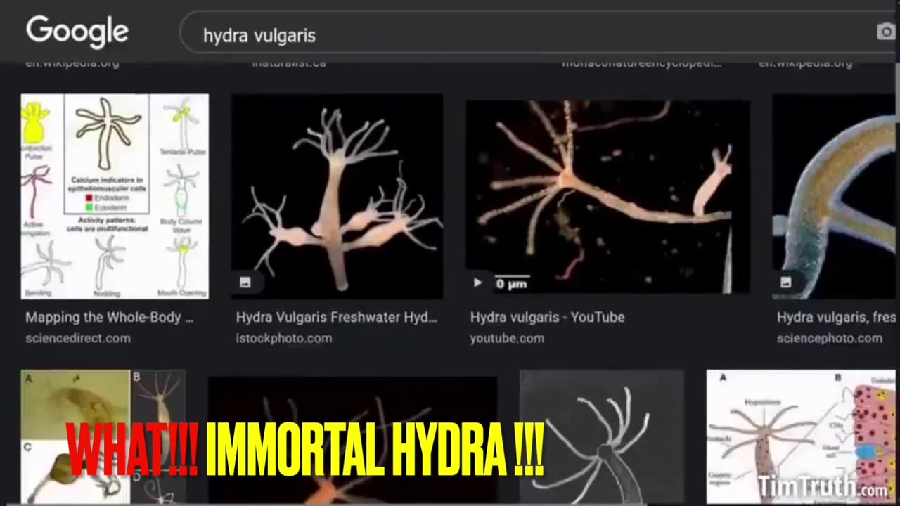 Immortal Hydra Capable Of Cloning Itself Dr Carrie Madej Recent Discovery?