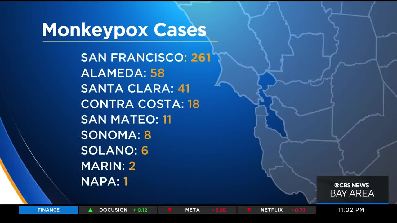 San Francisco declares emergency over monkeypox spread