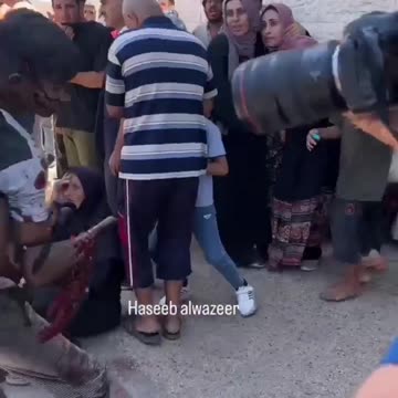 *Graphic* A terrorist from Gaza lost his hand in a firefight with the IDF