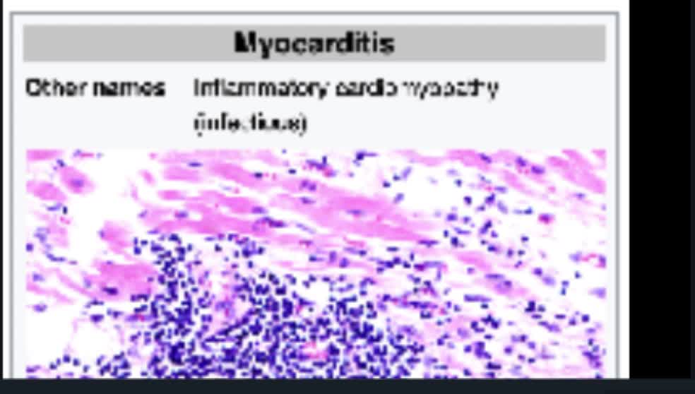 Pfizer-Alpertin Luento-Risteily Luotettaville Asiantuntijoille!