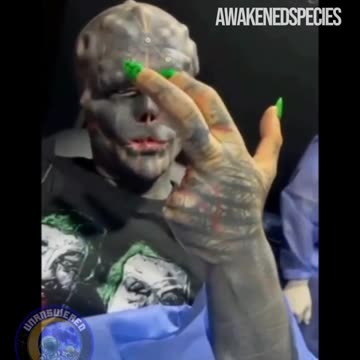 A man who is transforming himself to become a reptilian via surgery and body modifications.